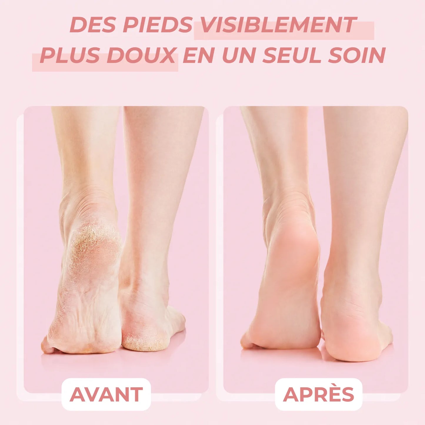 🩰 Peeling Masque chaussette exfoliant